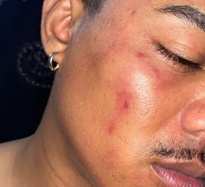 Comerciante denuncia presunto abuso policial ocurrido en Hainamosa